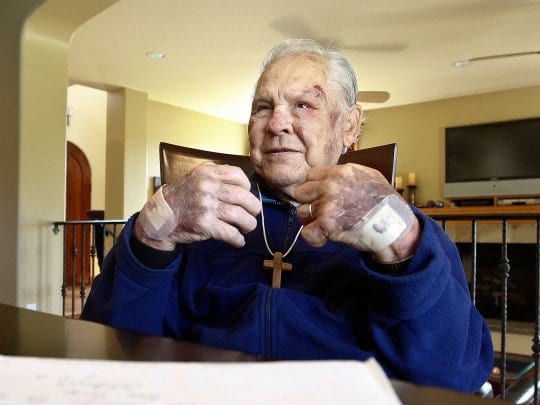 Bob Krause: Oldest Living Type 1 Diabetic