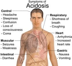 Lactic Acidosis Lactic Acidosis